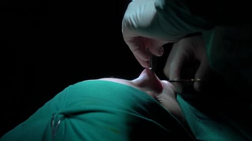 Rhinoplasty procedure and stitching doctor, end of operation.. Rhinoplasty procedure performed by a