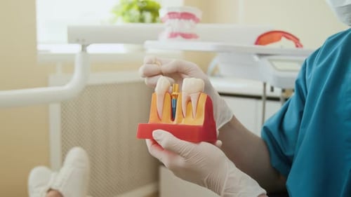 Dental Professional Demonstrating Dental Implant Procedure