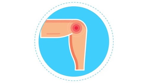 Knees pain Joint pain and Arthritis problems with pain point animation