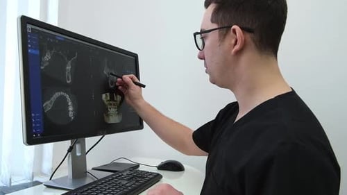 Dentist Doctor Examines a Panoramic Xray of the Jaw on a Computer Screen The Doctor Shows a 3D Model