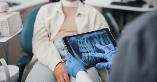 Dentist Explains Teeth X-Ray to Patient