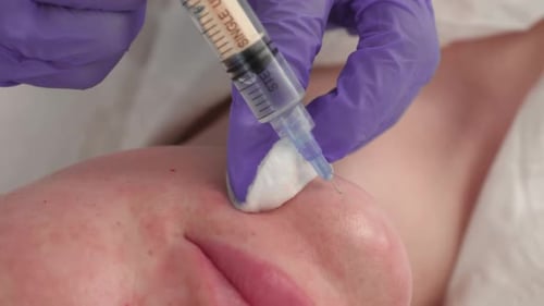 Close Up Medical Injection into Face