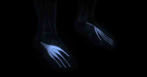 Extensor Digitorum Brevis, Motion Graphics Incluyendo: digitorum y ...