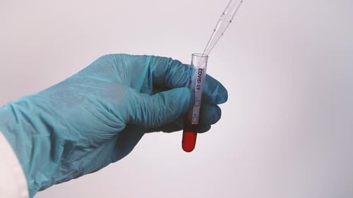 COVID-19 Blood Test in Laboratory Setting