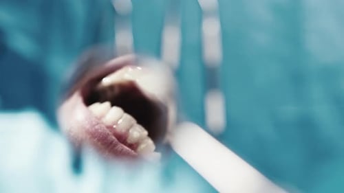 Dental Exam Close Up Using Mirror