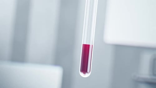Test Tube with Blood