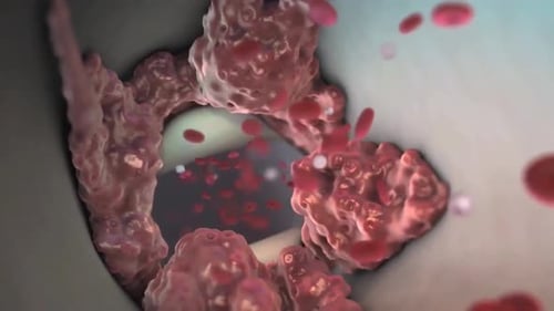 3D Medical Animation of Human Circulatory System with Blood Flow and Plaque