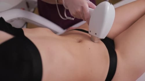 Laser in Aesthetic Medicine Epilation Woman on Laser Hair Removal Treatments Thighs and Bikini Area
