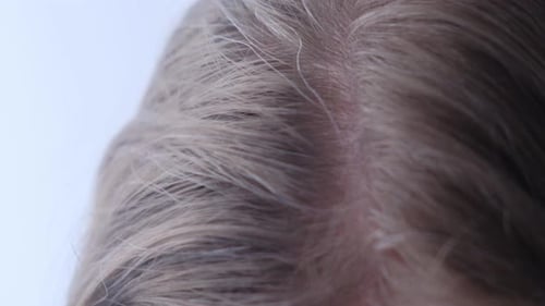Early Gray Hair of a Young Woman She is Worried and Stressed