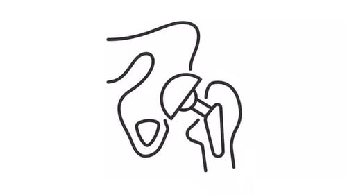 Flat Design Medical Animation of Hip Replacement Icon