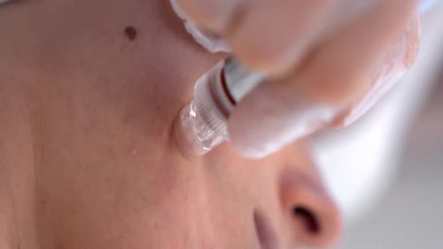 Close Up Cosmetic Procedure on Face