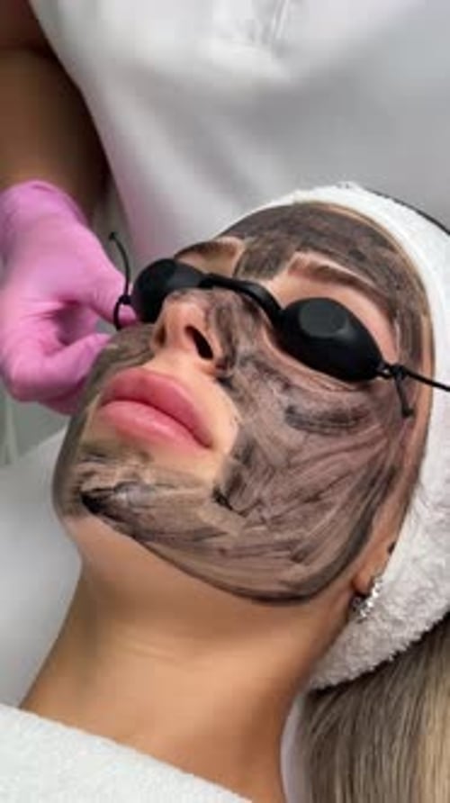 Woman Receiving Carbon Peel Facial Treatment at Spa