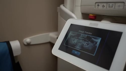 Dental x ray footage in dental operatory room