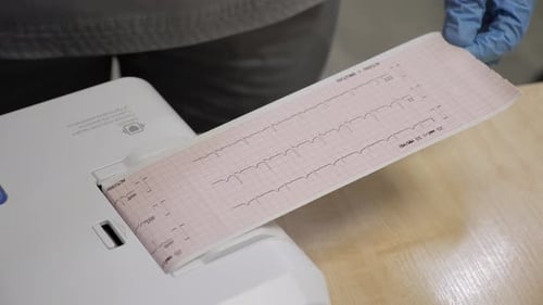 Hand des Kardiologen hält Kardiogramm-Patienten
