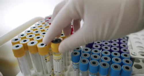 Gloved Hand Managing Medical Vials in Laboratory Setting