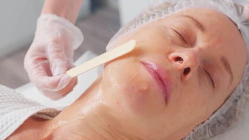 Woman Getting Fractional Microneedle RF Face Lifting Procedure in Beauty Salon