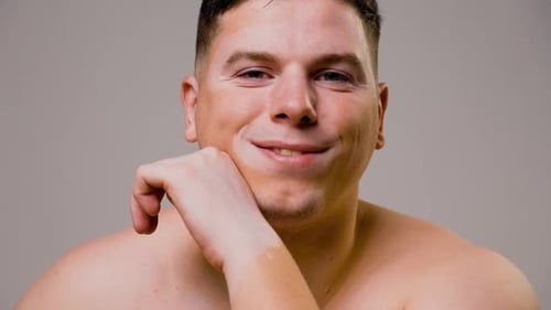 Genetic Disease Vitiligo is Not Studied Young Man Skin Pigmentation Show Concept Self Acceptance