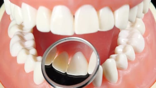 Patient at a Dentist Appointment in a Dental Clinic. View to Inside the Dental Jaw. Tooth Model