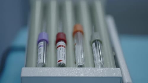Blood Sample Test Tubes in Medical Laboratory