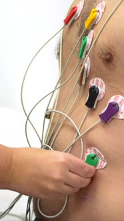 Adhesive Pads and Colored Clips Attached for Health Monitoring