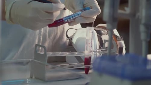 Scientist Handling Blood Sample in Medical Lab