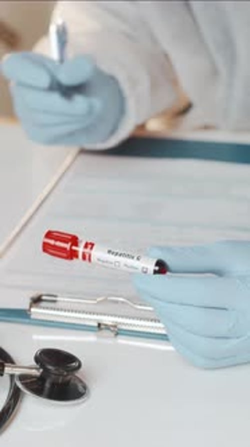 Hepatitis C Test, Medical Data Recording