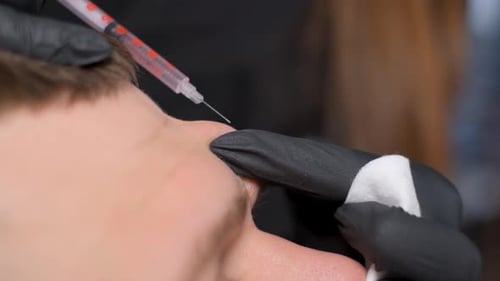 Close Up of Injection on Forehead