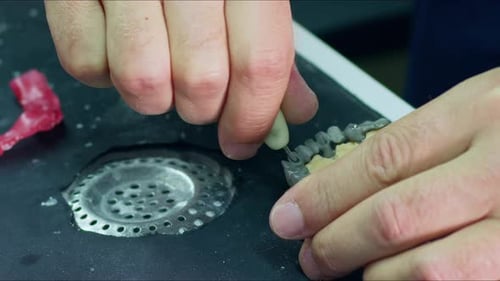 Hands Crafting Dental Implants in Lab Close Up