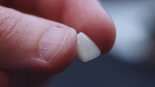 Dental Veneer Close Up Between Two Fingers