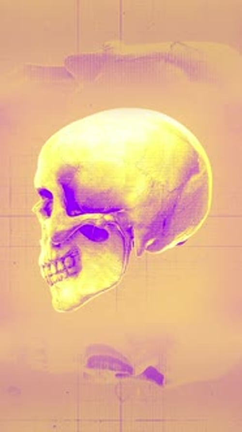 Medical Chart Skull 04