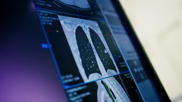 the patient undergoes computer tomography in the clinic, the ...