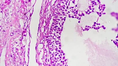 Microscopic View of Pink and Purple Stained Cells
