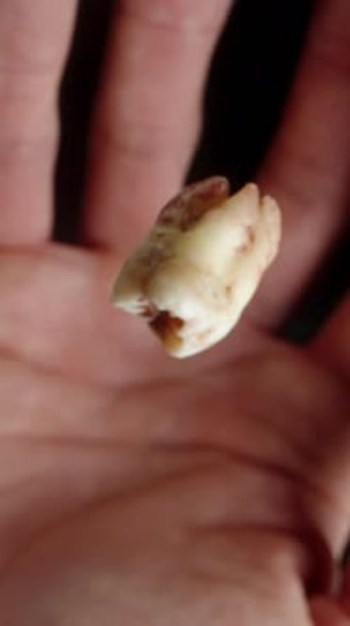 Vertical video. Tooth spins and falls onto the hand, man clenches it in his palm. Slow motion.