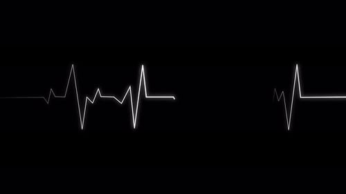 Animated ECG Heartbeat Monitor Line Graphic