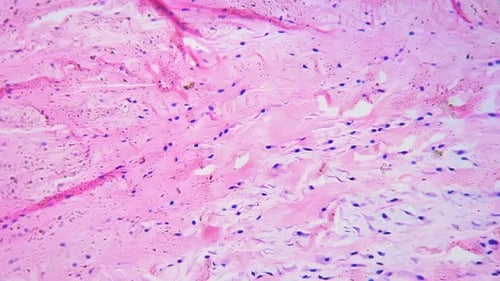 Dense Connective Tissue in Longitudinal Section Filmed By Microscope 200x on Bright Field