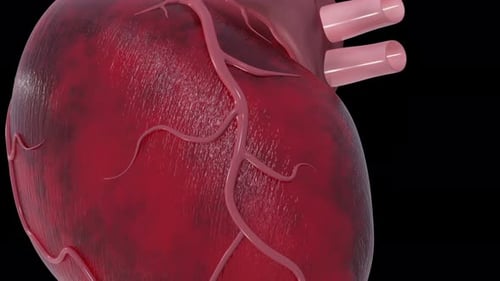 Animated human heart beating with blocked artery and cholesterol buildup