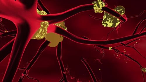spread of cancer cells On body tissues.