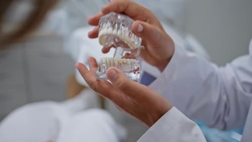 Dentist Hands Holding Dental Model in Stomatology Clinic Closeup Unknown Woman