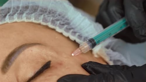 Adult Getting Face Injection Close Up