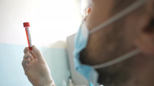 Test Tube with COVID Positive Results in Hospital