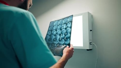 Close-up shot a radiologist carefully examines the MRI image on special board and describes he saw