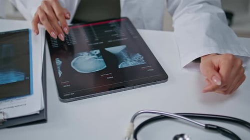 Doctor Examining Skull Xray on Tablet at Hospital Closeup Physician Hands