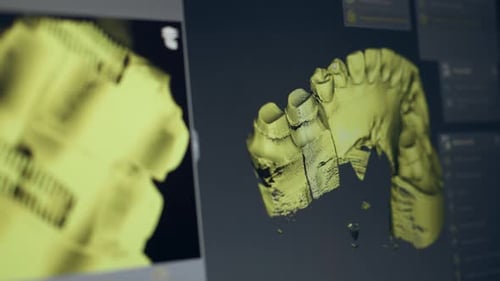 Close Up Professional Laboratory for Production of Dental Protozoa Veneers and Crowns in a Scanning