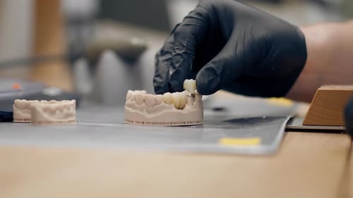 Close Up Professional Laboratory for the Production of Dental Protoses Veneers and Crowns a