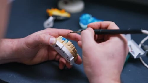 Male hands hold the denture model. Professional uses a tool for teeth implantation. Close up.