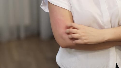 Die Geste der Frau kratzt sich am Arm und deutet auf die unsichtbare Verbindung zwischen psychologischen Zuständen und