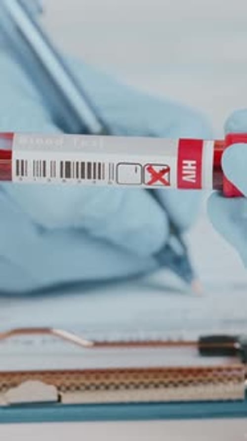 Doctor Conducts Essential Blood Test With HIV Labeled Tube in Clinic