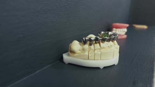 Moules dentaires en porcelaine et zirconium sur l'étagère 1