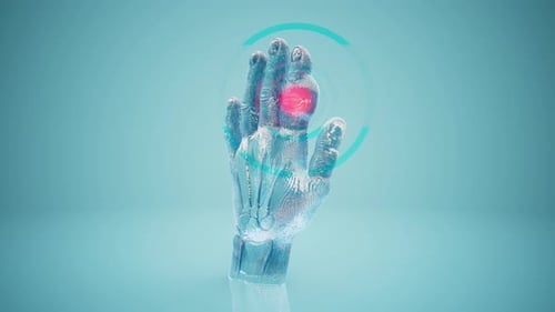 3D Medical Animation of Human Hand Pain and Digital Scan