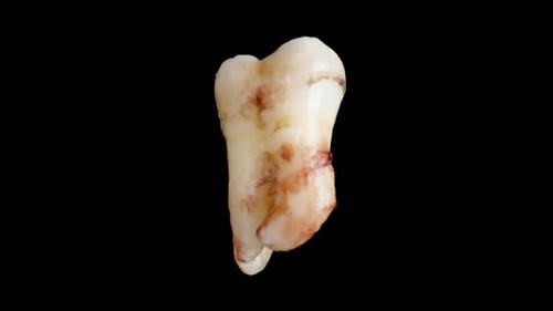 Rotating Molar Close Up on Black Background